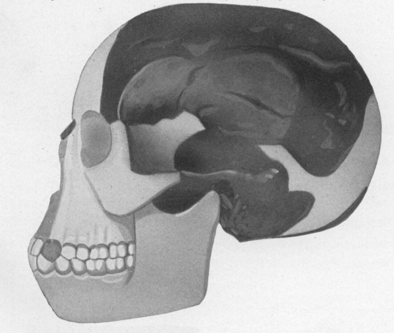 Piltdown Man: The Fossil That Flattered an Expectation feature image